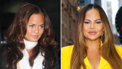 Did Chrissy Teigen Get Plastic Surgery See Photos of Her Transformation 107