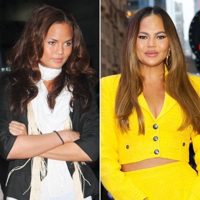 Did Chrissy Teigen Get Plastic Surgery See Photos of Her Transformation 107