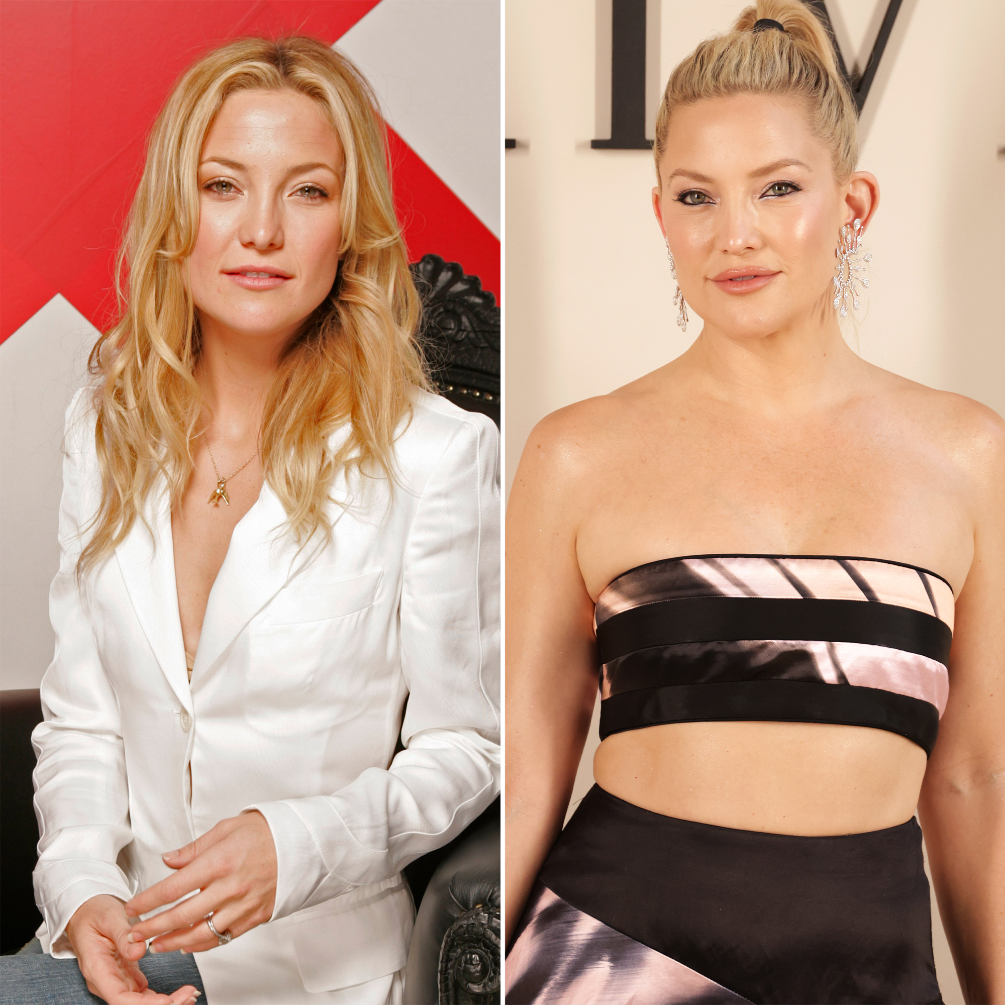 Did Kate Hudson Ever Get Plastic Surgery