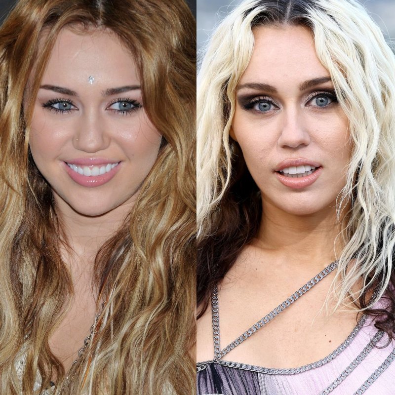 Young Celebrities Experts Believe Have Had Plastic Surgery