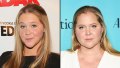 Has Amy Schumer Had Plastic Surgery 786
