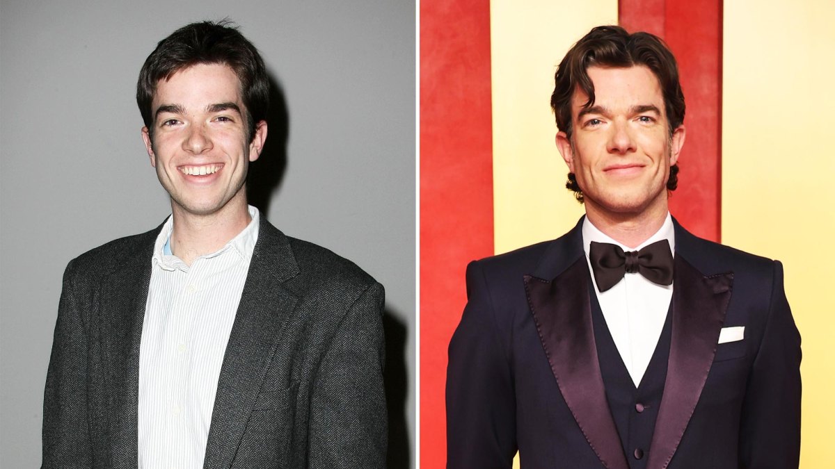 Has John Mulaney Had Plastic Surgery