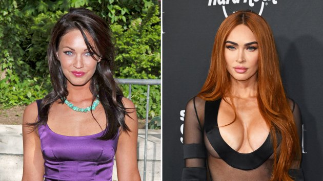 Megan Fox Plastic Surgery: Has She Gone Under the Knife? | Life & Style Megan Fox Plastic Surgery: Has She Gone Under the Knife? | Life & Style