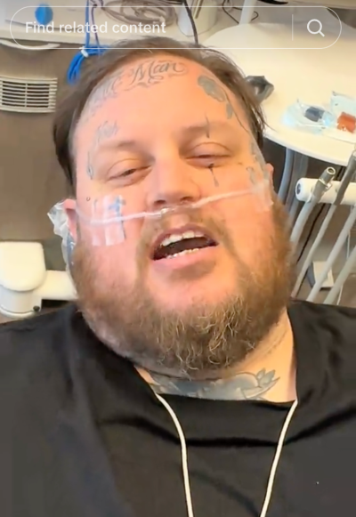 jelly roll gets his teeth redone in reconstructive surgery
