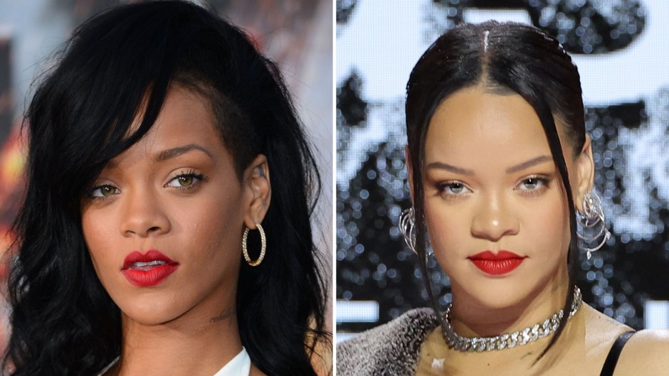 Rihanna Plastic Surgery Transformation: Before, After Photos