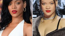Did Rihanna Get Plastic Surgery? The Singer Wants *This* Procedure Done