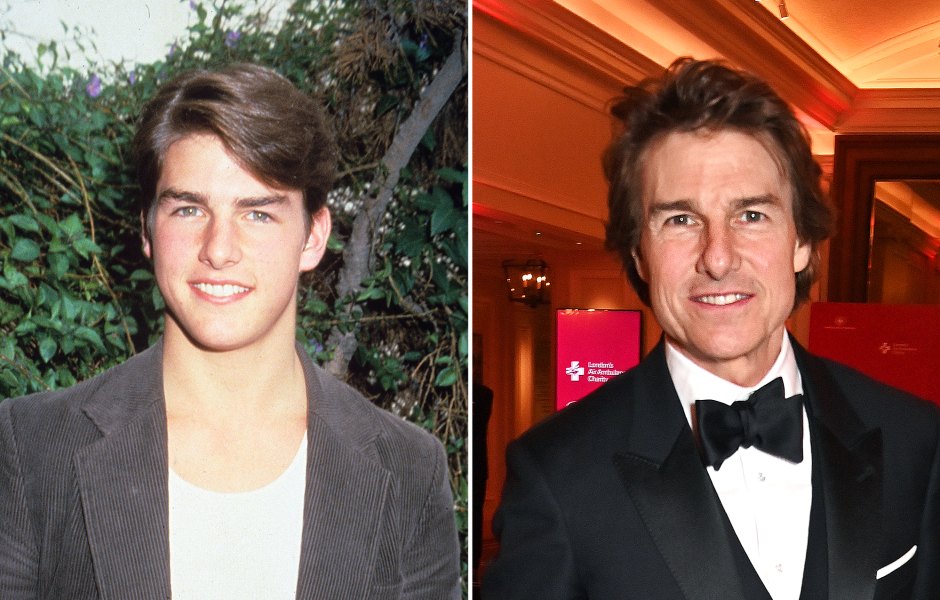 Did Tom Cruise Get Plastic Surgery Photos of His Transformation