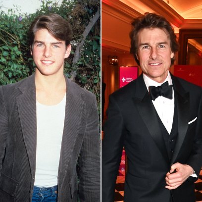 Did Tom Cruise Get Plastic Surgery Photos of His Transformation