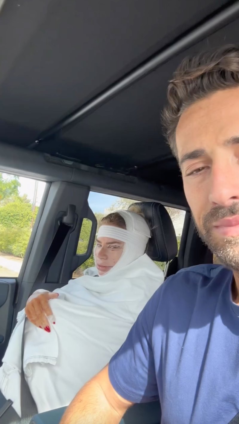 RHODubai’s Caroline Stanbury Plastic Surgery: Before and After