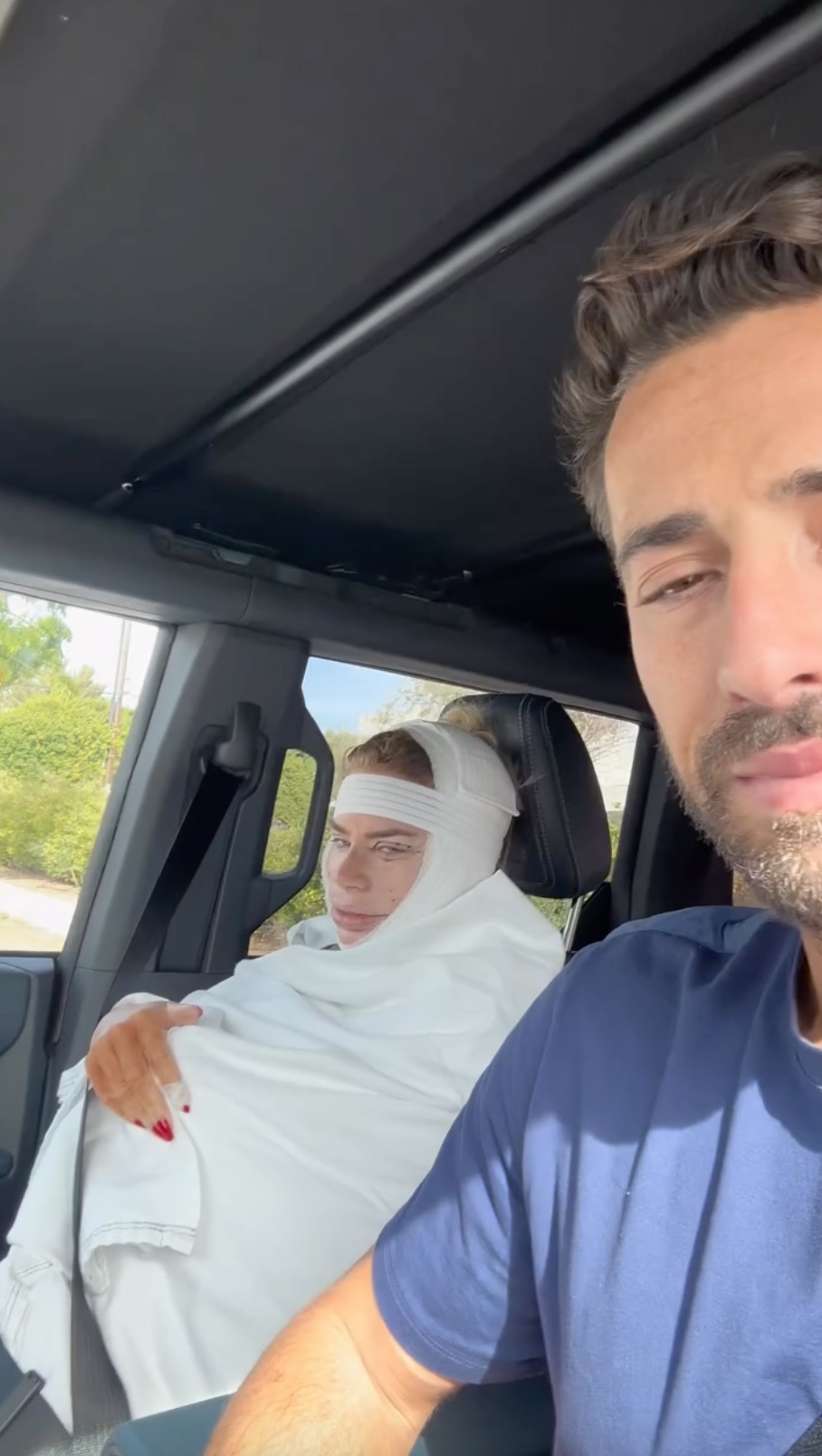 RHODubai’s Caroline Stanbury Plastic Surgery: Before and After