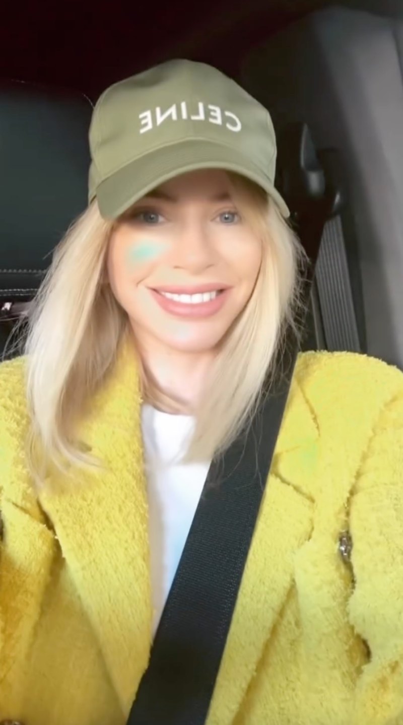 RHODubai’s Caroline Stanbury Plastic Surgery: Before and After