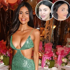 Holly Scarfone’s Plastic Surgery: Before, After Photos