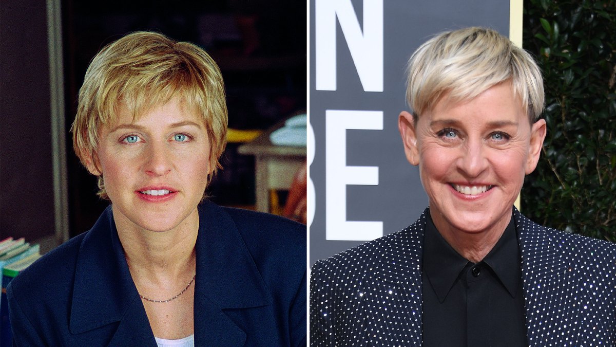 Did Ellen DeGeneres Get Plastic Surgery Transformation Photos From Then and Now