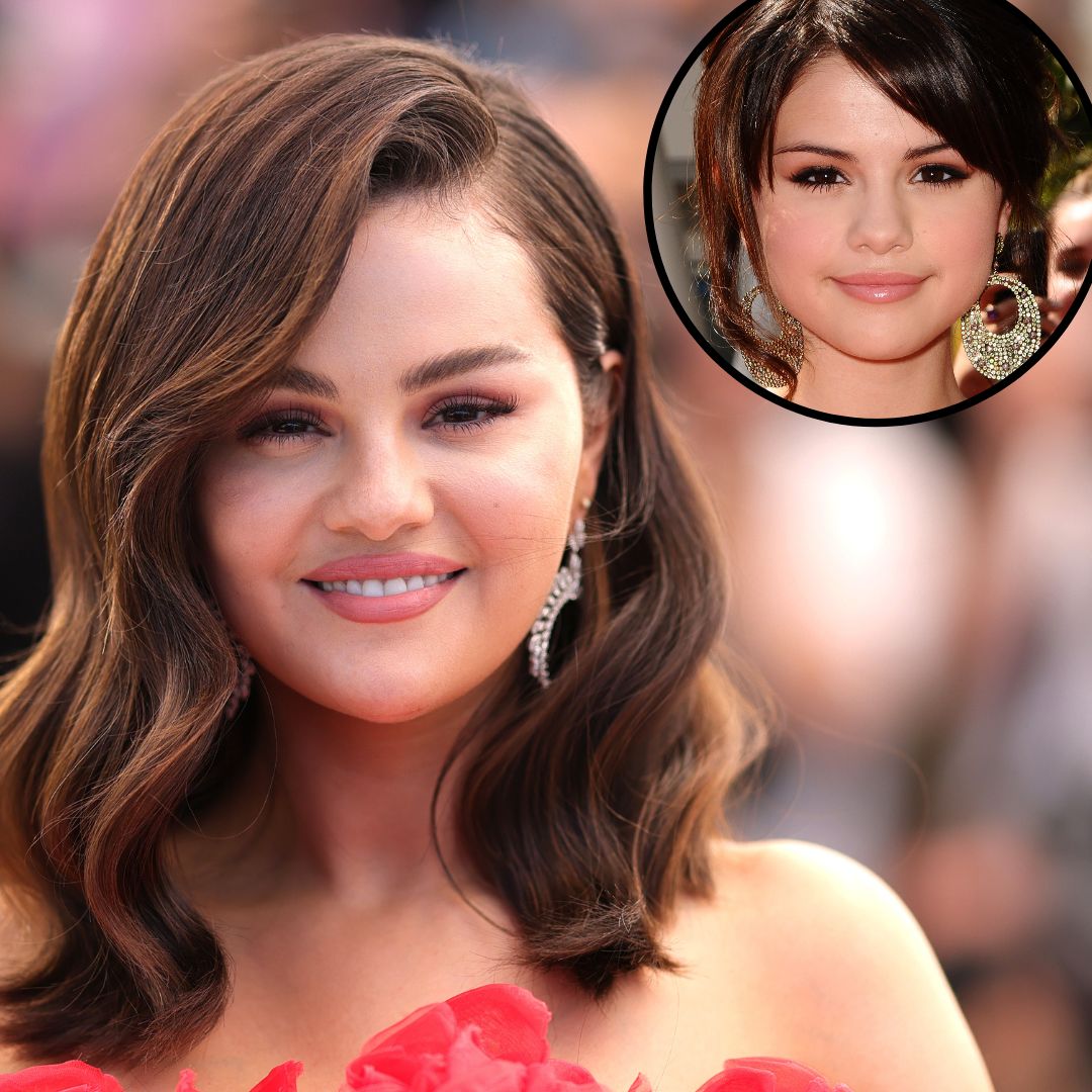 Plastic Surgery Confessions! Stars Going Under the Knife