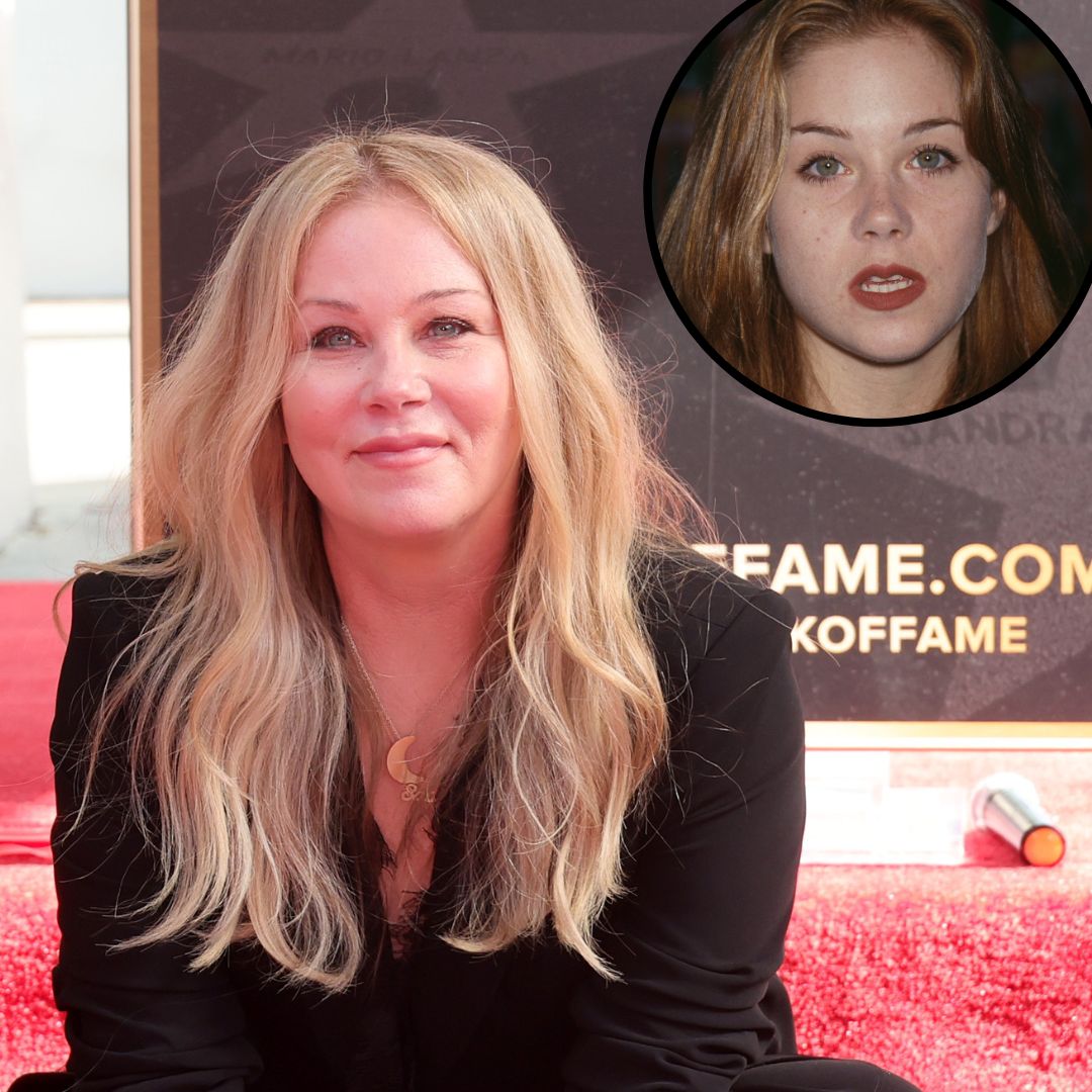 Plastic Surgery Confessions! Stars Going Under the Knife