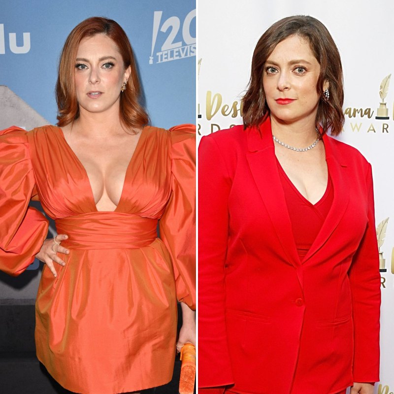 Plastic Surgery Confessions! Stars Going Under the Knife