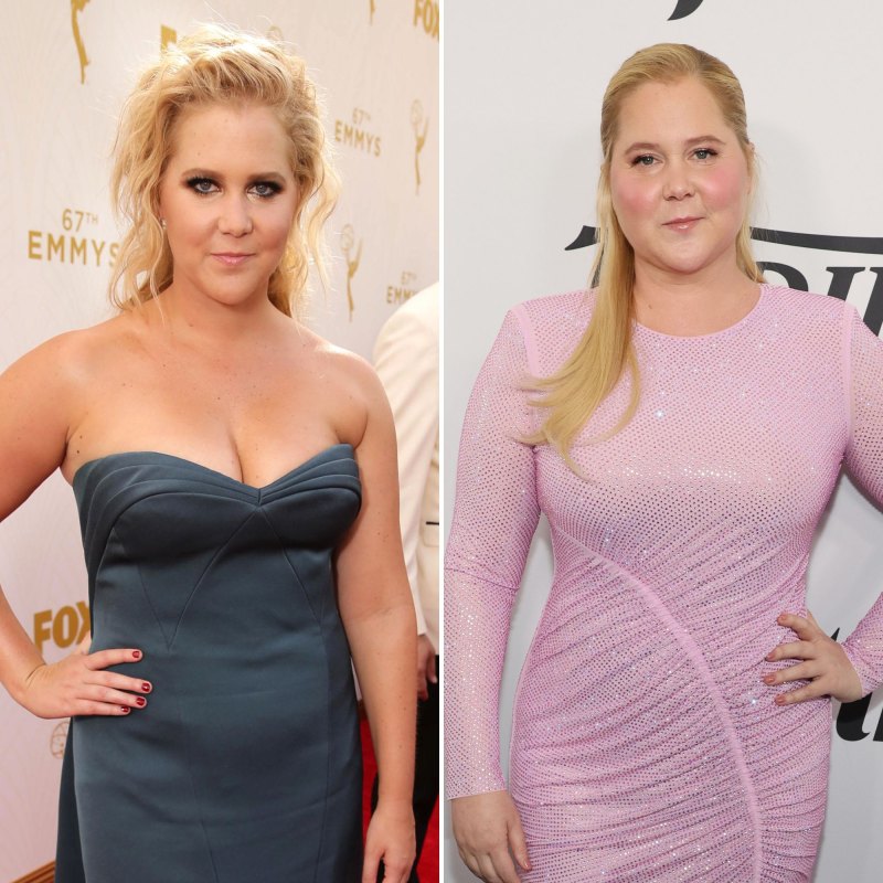 Plastic Surgery Confessions! Stars Going Under the Knife