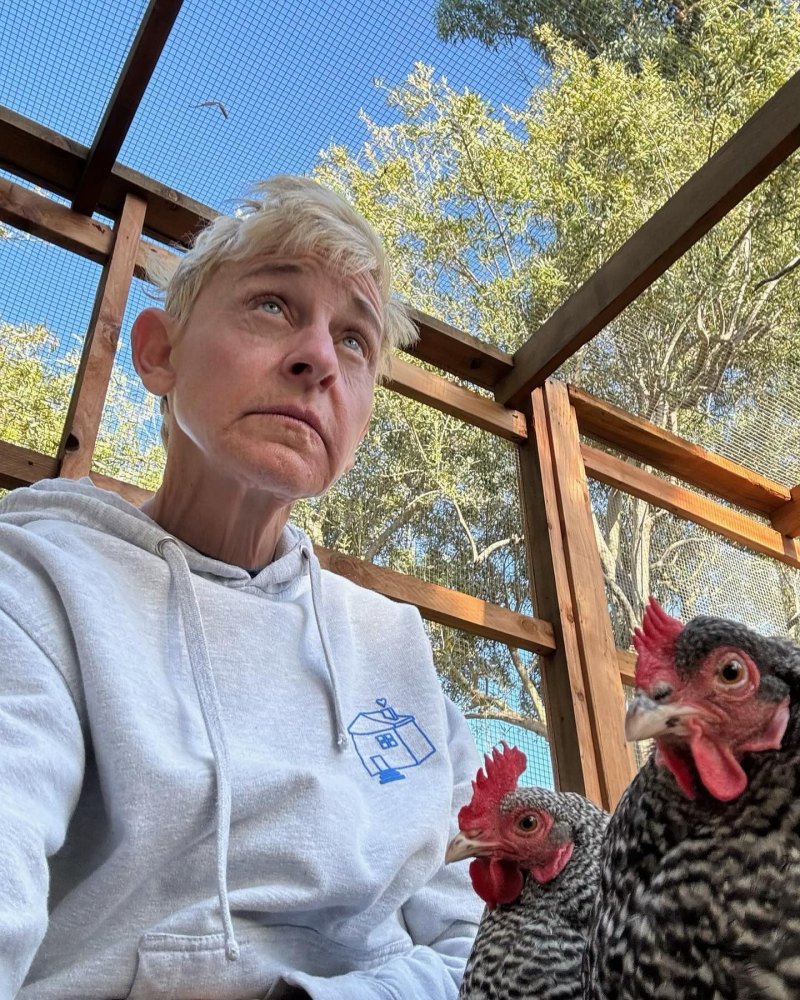 ellen degeneres plastic surgery 13