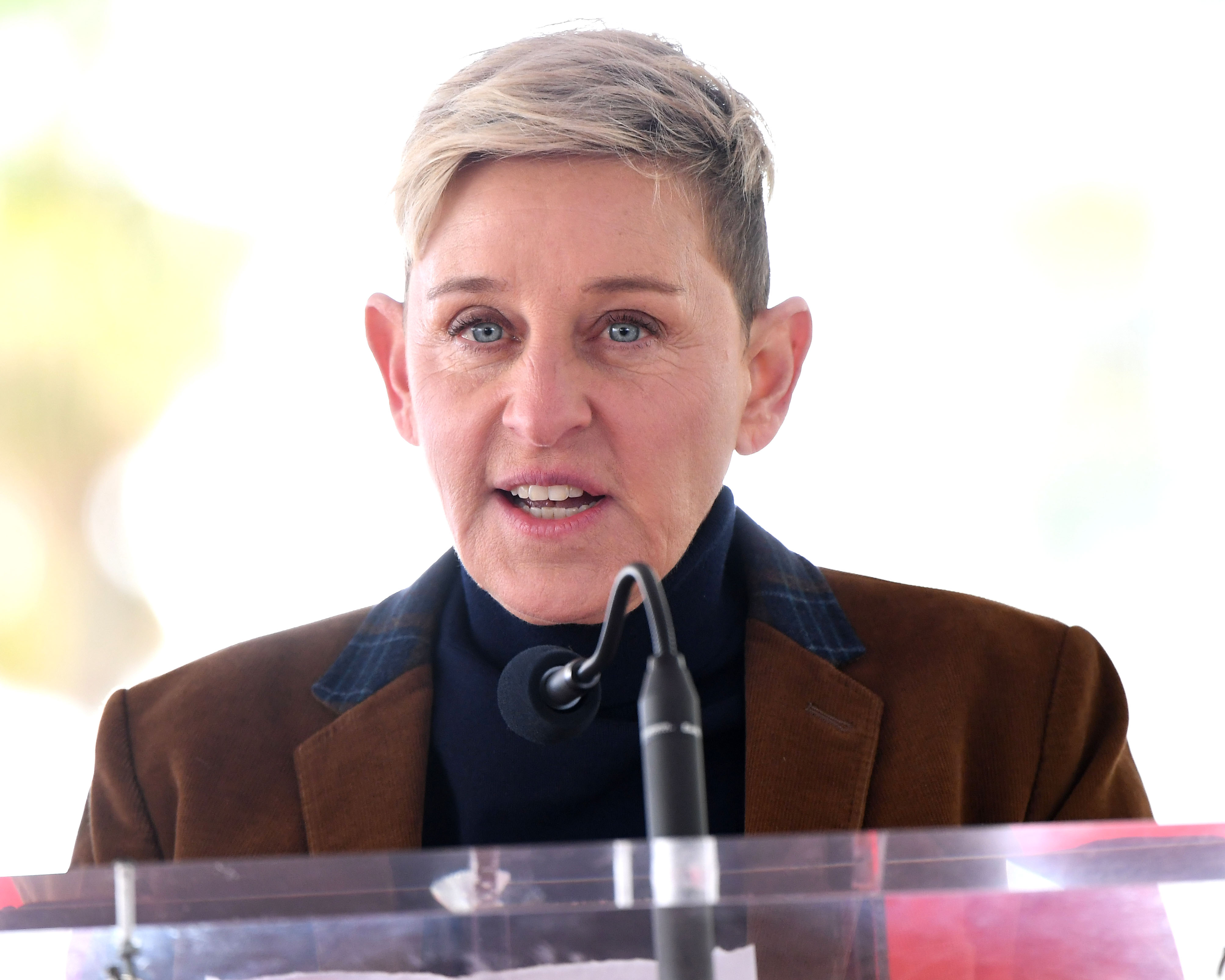 ellen-degeneres-plastic-surgery