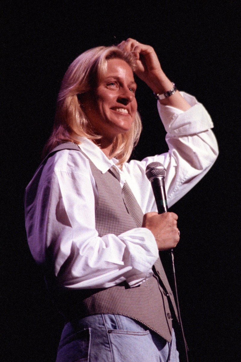 ellen-degeneres-plastic-surgery