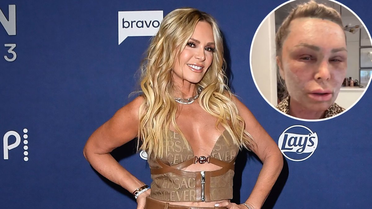 Promo RHOC Tamra Judge Looks Unrecognizable After Plastic Surgery
