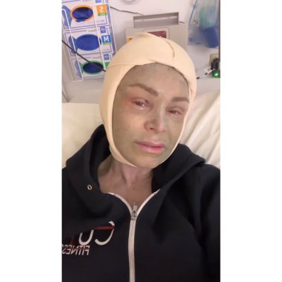 RHOC Tamra Judge Looks Unrecognizable After Plastic Surgery 1