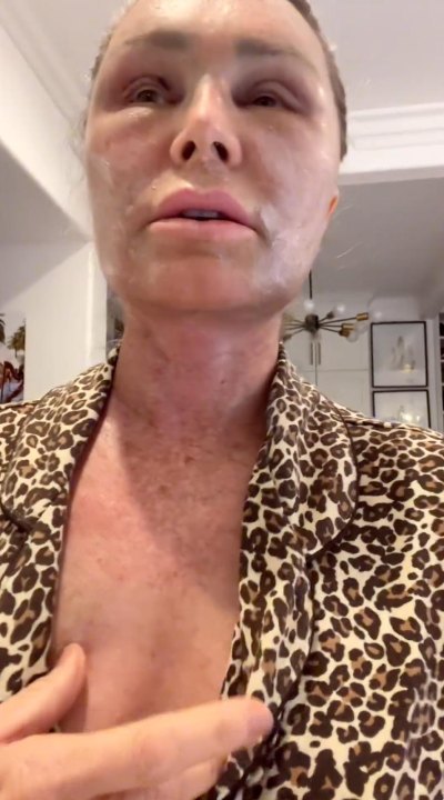 RHOC's Tamra Judge Is Swearing off Plastic Surgery After Brow Lift, Chemical Peel
