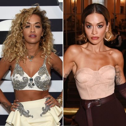 rita ora plastic surgery