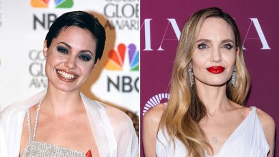 Did Angelina Jolie Get Plastic Surgery