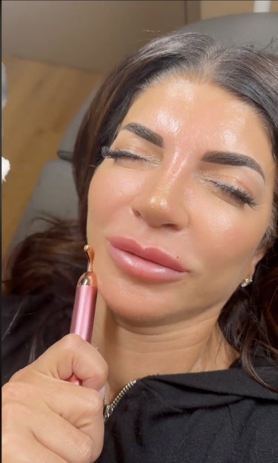 RHONJ’s Teresa Giudice Dissolves Her Lip Filler in Graphic Video: ‘A Little Bit Nervous’