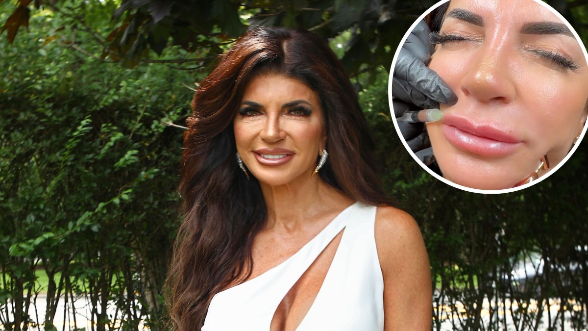 RHONJ’s Teresa Giudice Dissolves Her Lip Filler in Graphic Video: ‘A Little Bit Nervous’
