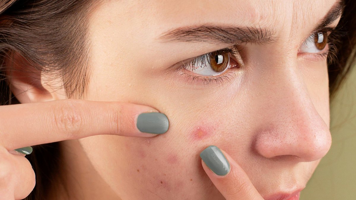 Better Skin