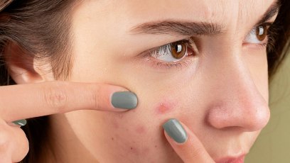 Better Skin