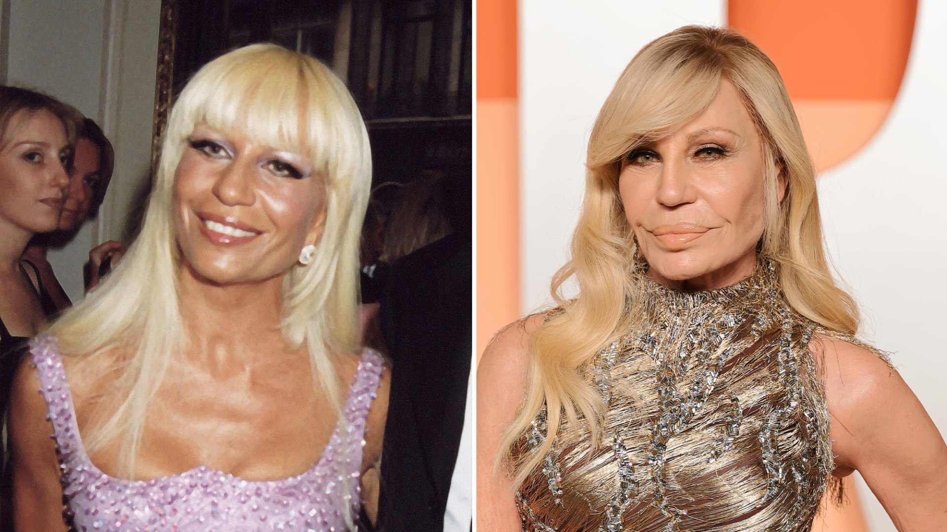 Has Donatella Versace Had Plastic Surgery? Before and After Photos