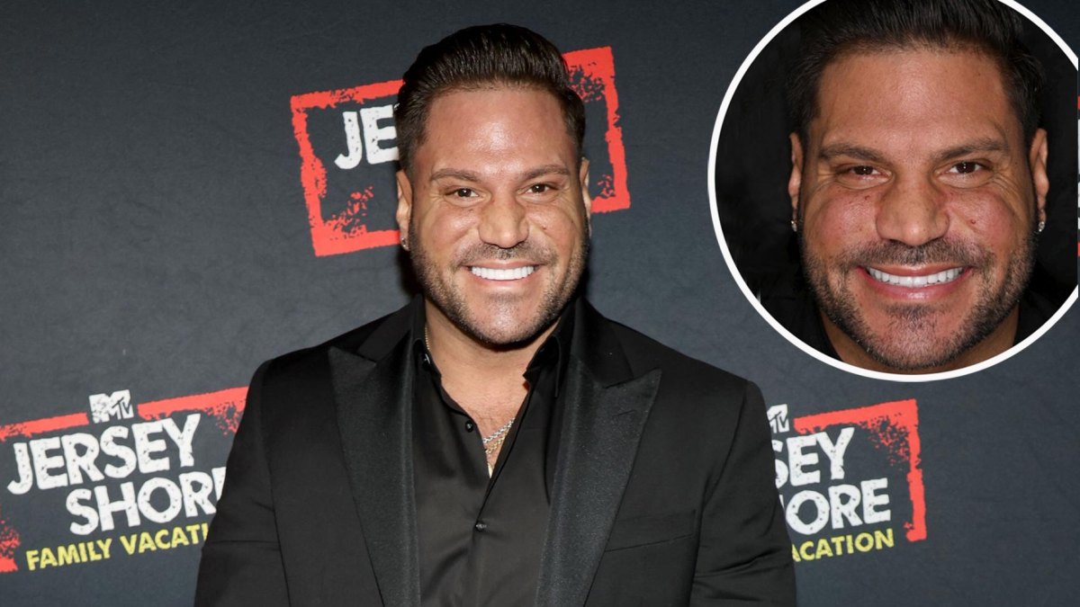 Jersey Shore Star Ronnie Ortiz Magros Smile Makeover