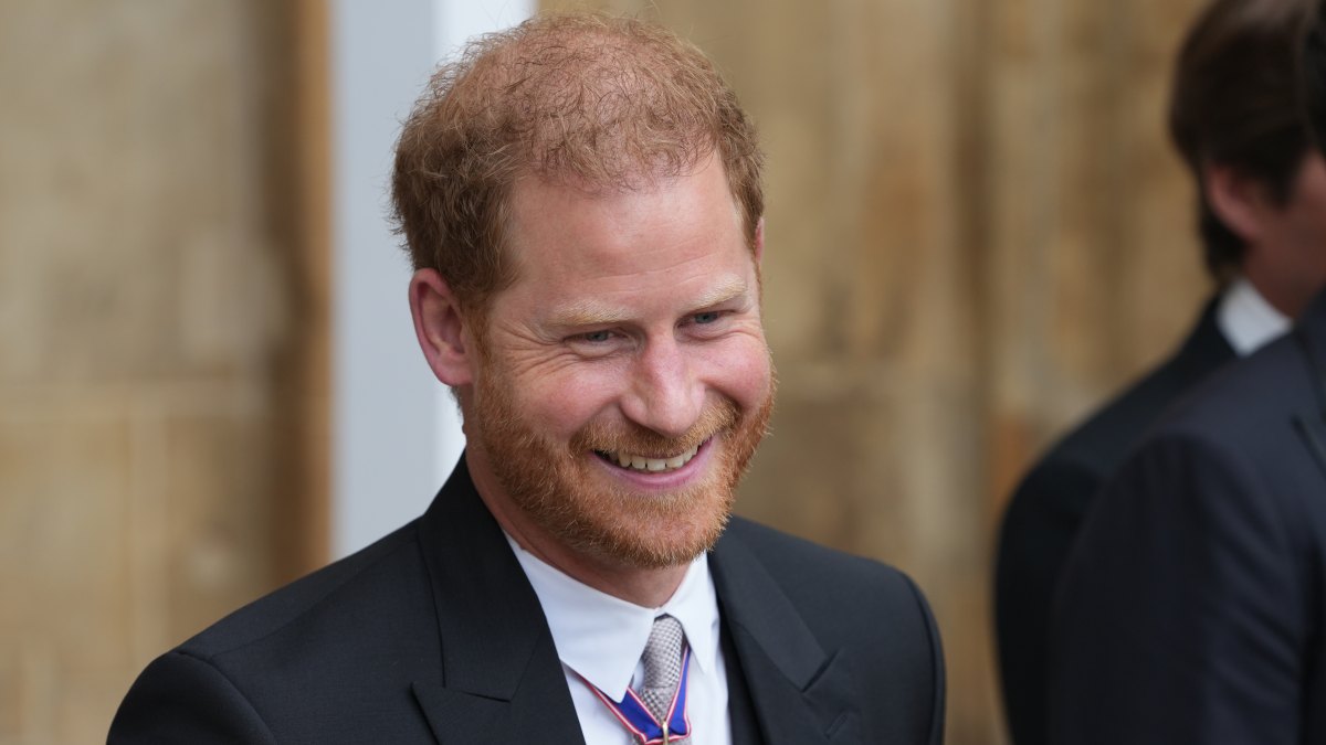 Prince Harry 'Takes Pride' in His Thinning Mane (EXCL)