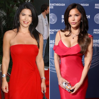 Lauren Sanchez Plastic Surgery Transformation