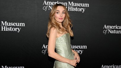 Chloe Fineman Shares a Peak Into Her "Botched" Cosmetic Procedures