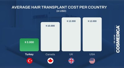 : Turkey’s hair transplant industry attracts international patients with lower costs and all-inclusive packages